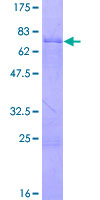 ab159052 on a 12.5% SDS-PAGE stained with Coomassie Blue.