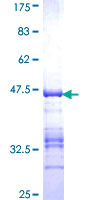 ab159053 on a 12.5% SDS-PAGE stained with Coomassie Blue.