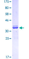 ab152590 on a 12.5% SDS-PAGE stained with Coomassie Blue.