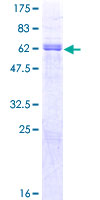 ab152592 on a 12.5% SDS-PAGE stained with Coomassie Blue.