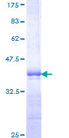 ab159054 on a 12.5% SDS-PAGE stained with Coomassie Blue.