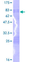 ab159055 on a 12.5% SDS-PAGE stained with Coomassie Blue.