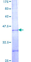 ab159056 on a 12.5% SDS-PAGE stained with Coomassie Blue.