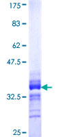 ab159057 on a 12.5% SDS-PAGE stained with Coomassie Blue.