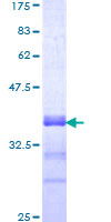 ab159058 on a 12.5% SDS-PAGE stained with Coomassie Blue.