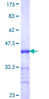 ab159066 on a 12.5% SDS-PAGE stained with Coomassie Blue.