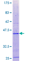 ab164495 on a 12.5% SDS-PAGE stained with Coomassie Blue.