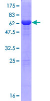 ab162715 on a 12.5% SDS-PAGE stained with Coomassie Blue.