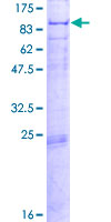ab159059 on a 12.5% SDS-PAGE stained with Coomassie Blue.