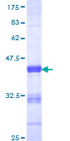 ab159061 on a 12.5% SDS-PAGE stained with Coomassie Blue.