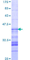 ab162145 on a 12.5% SDS-PAGE stained with Coomassie Blue.