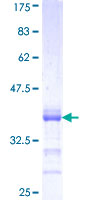 ab163348 on a 12.5% SDS-PAGE stained with Coomassie Blue.