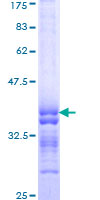 ab163335 on a 12.5% SDS-PAGE stained with Coomassie Blue.