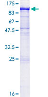 ab163346 on a 12.5% SDS-PAGE stained with Coomassie Blue.