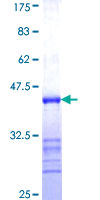 ab163345 on a 12.5% SDS-PAGE stained with Coomassie Blue.