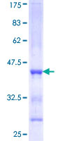 ab163344 on a 12.5% SDS-PAGE stained with Coomassie Blue.