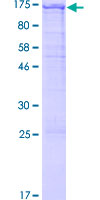 ab163340 on a 12.5% SDS-PAGE stained with Coomassie Blue.