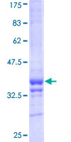 ab163341 on a 12.5% SDS-PAGE stained with Coomassie Blue.