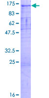 ab163338 on a 12.5% SDS-PAGE stained with Coomassie Blue.
