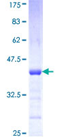 ab163339 on a 12.5% SDS-PAGE stained with Coomassie Blue.
