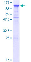 ab163337 on a 12.5% SDS-PAGE stained with Coomassie Blue.