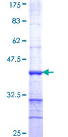 ab160641 on a 12.5% SDS-PAGE stained with Coomassie Blue.