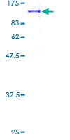 ab163322 on a 12.5% SDS-PAGE stained with Coomassie Blue.