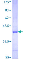 ab163323 on a 12.5% SDS-PAGE stained with Coomassie Blue.