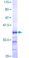 ab161917 on a 12.5% SDS-PAGE stained with Coomassie Blue.