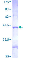 ab163320 on a 12.5% SDS-PAGE stained with Coomassie Blue.