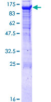 ab160618 on a 12.5% SDS-PAGE stained with Coomassie Blue.