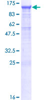 ab163311 on a 12.5% SDS-PAGE stained with Coomassie Blue.
