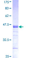 ab163312 on a 12.5% SDS-PAGE stained with Coomassie Blue.