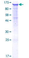 ab163309 on a 12.5% SDS-PAGE stained with Coomassie Blue.