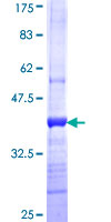ab163310 on a 12.5% SDS-PAGE stained with Coomassie Blue.