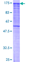 ab159062 on a 12.5% SDS-PAGE stained with Coomassie Blue.