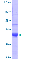 ab159063 on a 12.5% SDS-PAGE stained with Coomassie Blue.