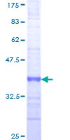 ab164655 on a 12.5% SDS-PAGE stained with Coomassie Blue.