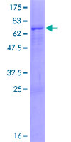 ab163035 on a 12.5% SDS-PAGE stained with Coomassie Blue.