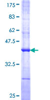 ab162017 on a 12.5% SDS-PAGE stained with Coomassie Blue.