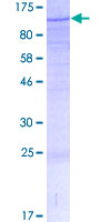 ab162600 on a 12.5% SDS-PAGE stained with Coomassie Blue.
