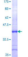 ab162601 on a 12.5% SDS-PAGE stained with Coomassie Blue.