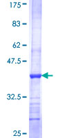 ab159069 on a 12.5% SDS-PAGE stained with Coomassie Blue.