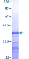 ab159071 on a 12.5% SDS-PAGE stained with Coomassie Blue.