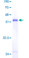 ab163676 on a 12.5% SDS-PAGE stained with Coomassie Blue.