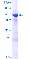 ab161164 on a 12.5% SDS-PAGE stained with Coomassie Blue.