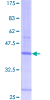 ab160804 on a 12.5% SDS-PAGE stained with Coomassie Blue.