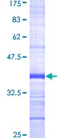 ab160805 on a 12.5% SDS-PAGE stained with Coomassie Blue.