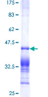 ab152596 on a 12.5% SDS-PAGE stained with Coomassie Blue.