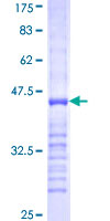 ab159080 on a 12.5% SDS-PAGE stained with Coomassie Blue.